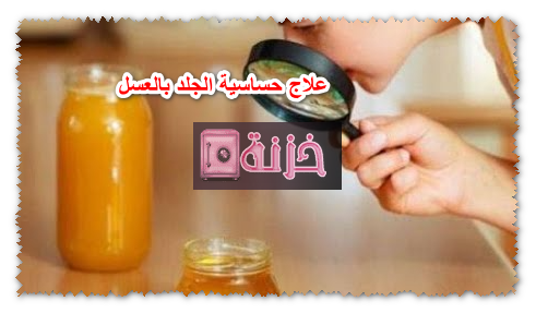 علاج حساسية الجلد بالعسل