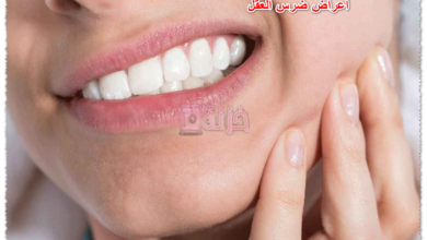 أعراض ضرس العقل