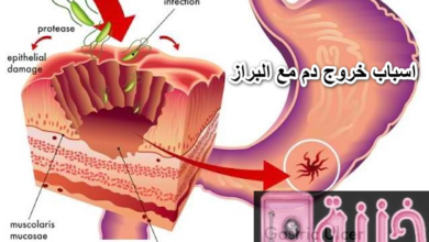 اسباب خروج دم مع البراز