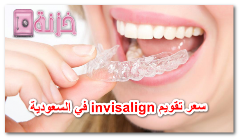 سعر تقويم invisalign في السعودية